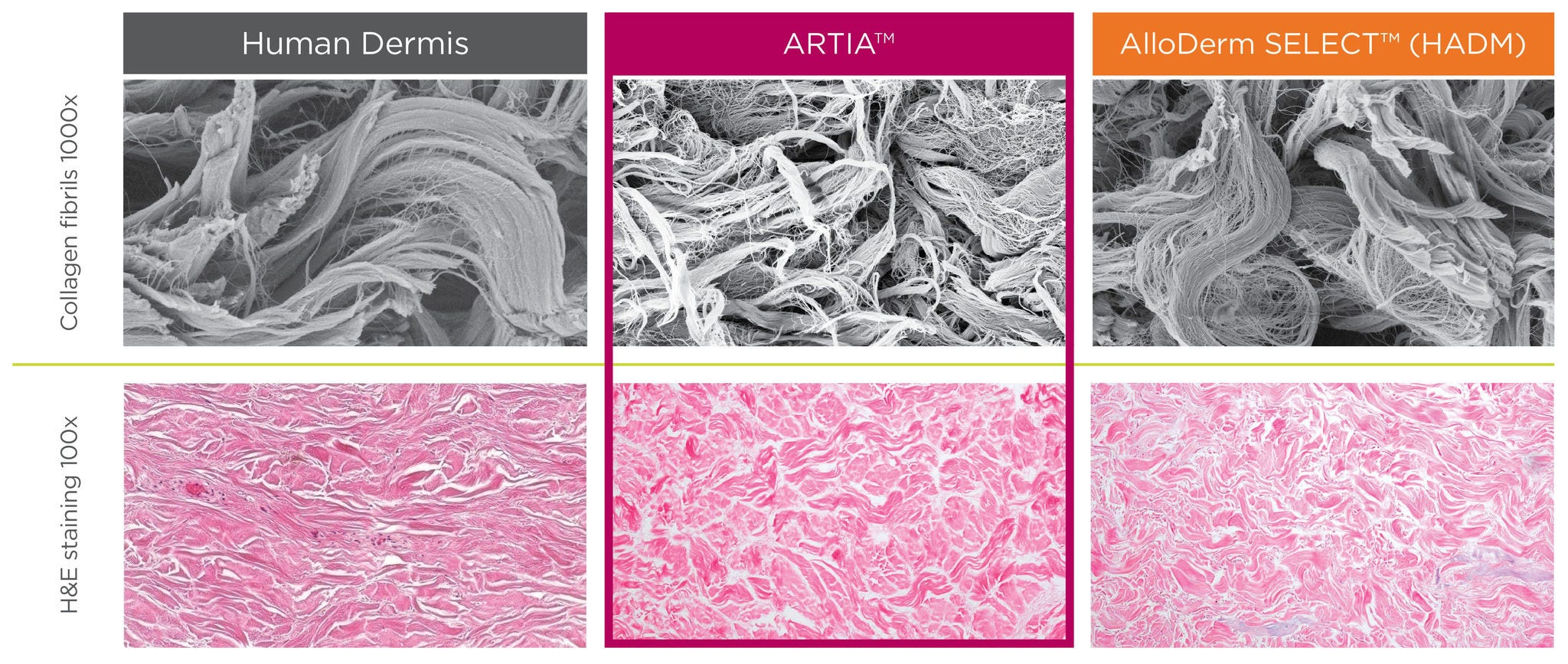  Histological and scanning electron microscope images of human dermis, ARTIA™, and AlloDerm™ tissue matrix at 200x magnification and 1000x magnification, respectively.  