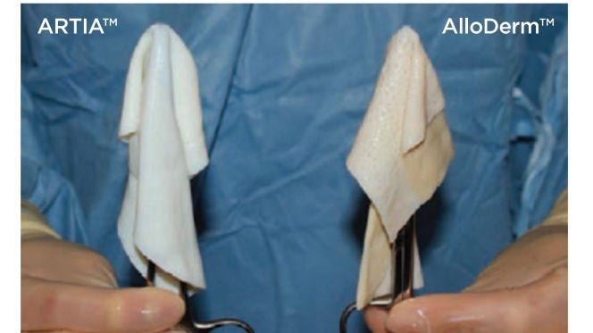 ARTIA™ and AlloDerm™ dropped on forceps