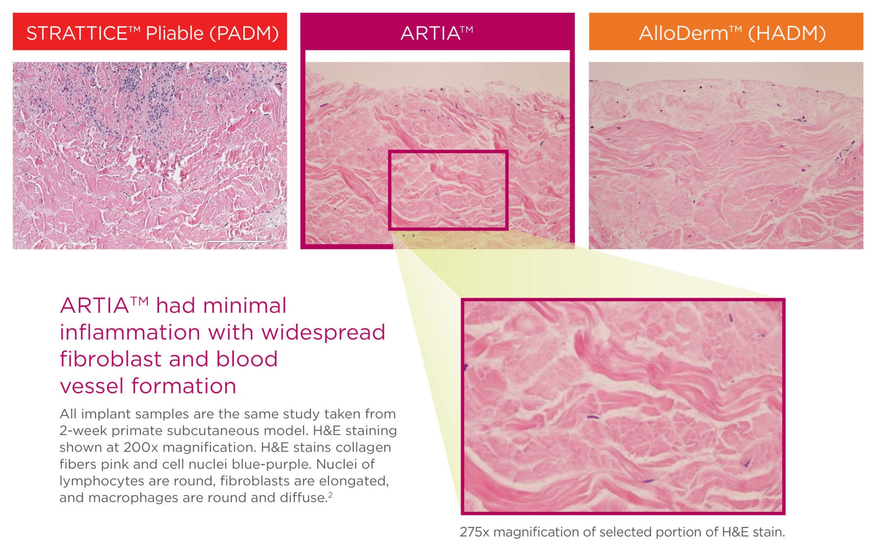 Positive biological response of STRATTICE™ Pliable, ARTIA™, and AlloDerm™